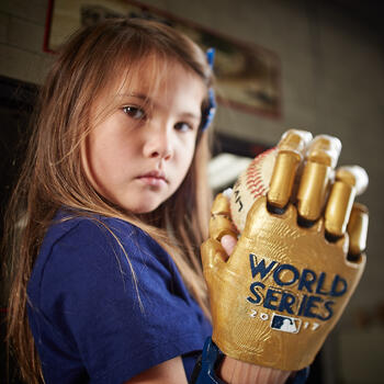 girl with prosthetic hand holding baseball