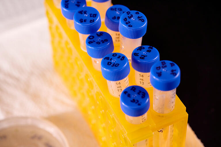 Photo of test tubes with yellow liquid 
