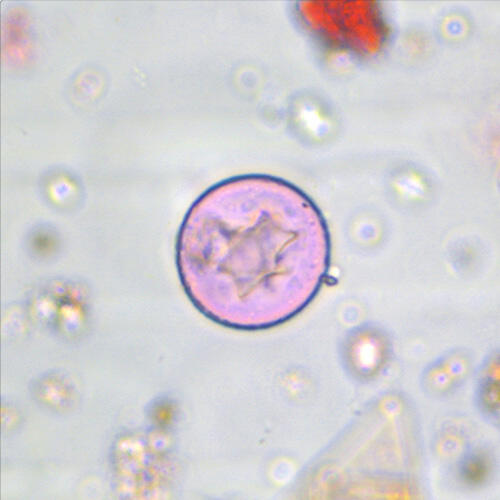 Cupressaceae (Cedar)