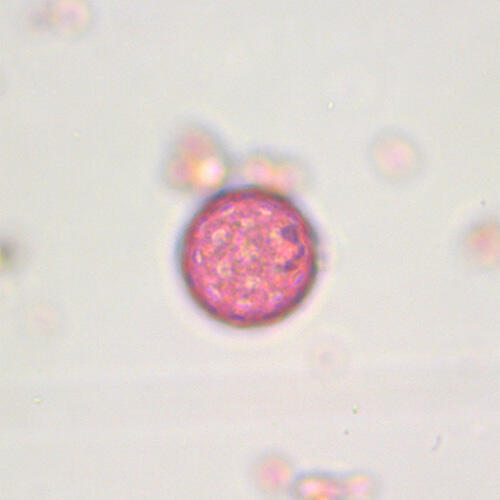 Chenopodiaceae (Pigweed)