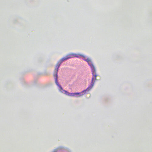 Eschscholzia (Poppy)