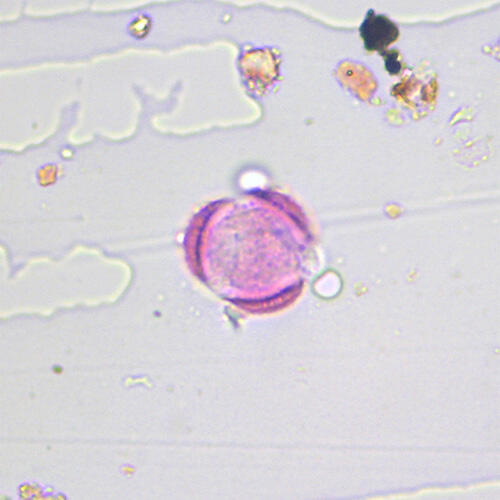 Artemisia (Sagebrush)