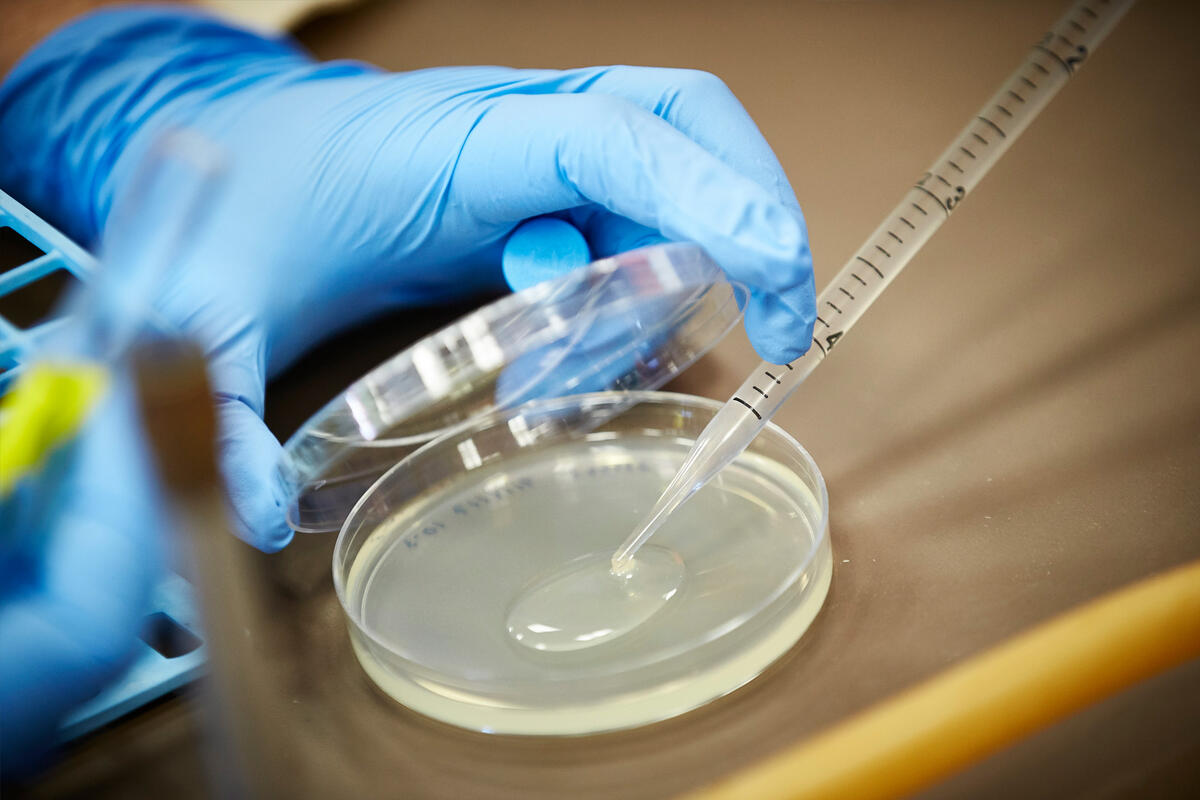 A hand holds the lid to a petri dish while a dropper samples a liquid from it.