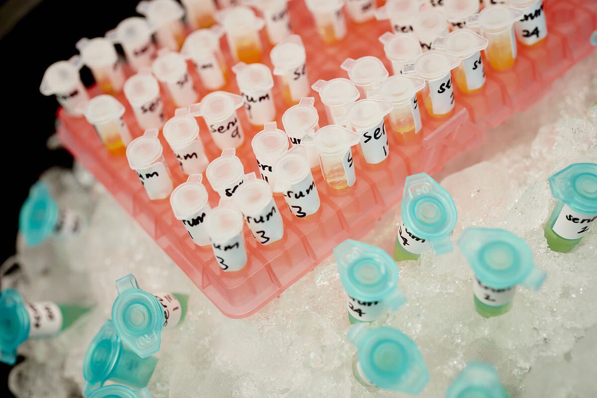 vials in a research lab
