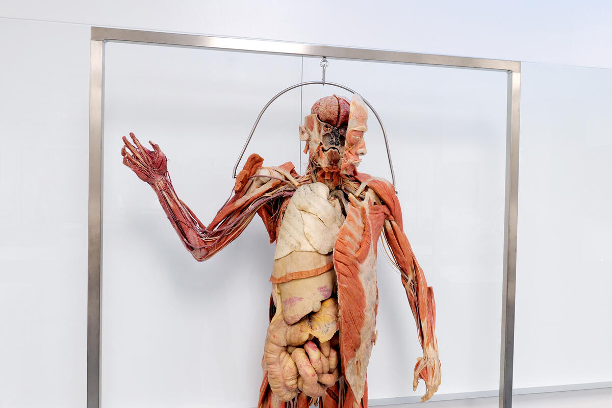 Plastinated specimen in the Kirk Kerkorian Medical Education Building's cadaver lab.