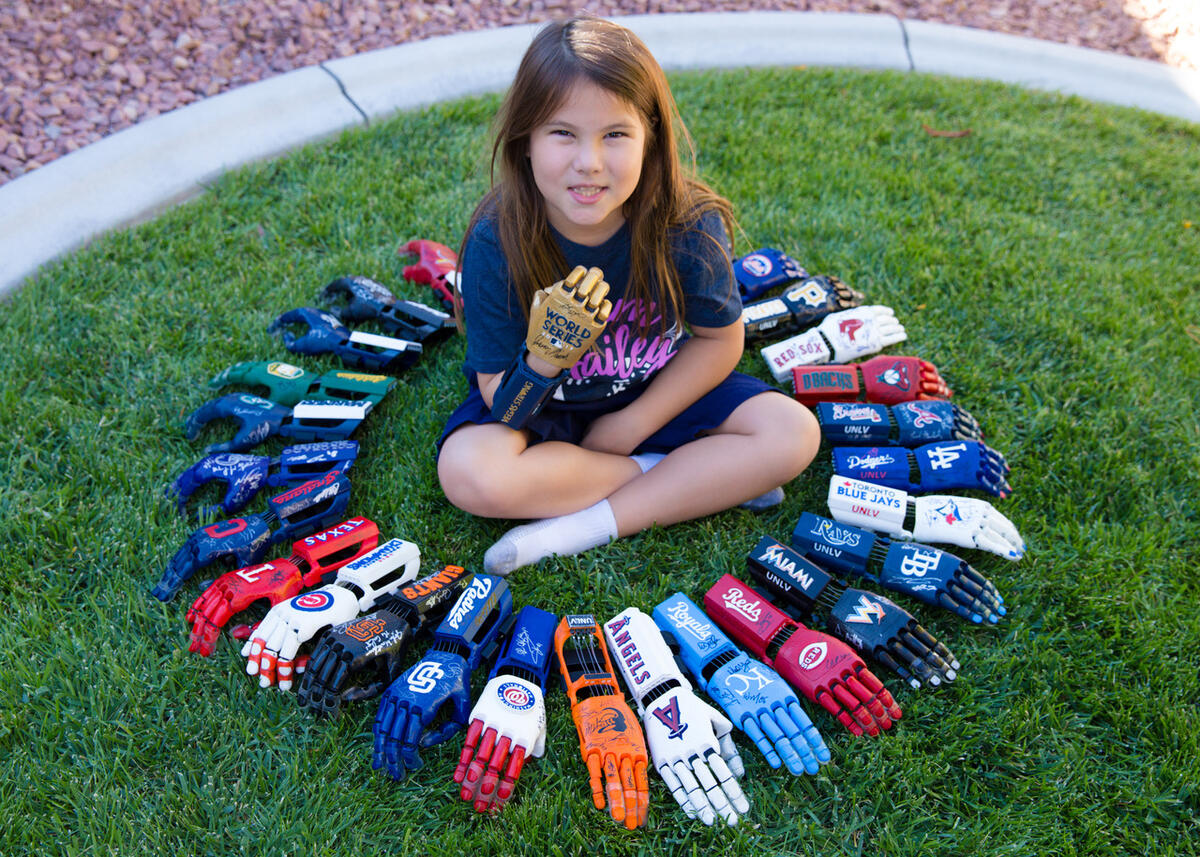 Hailey Dawson with 3d-printed hands