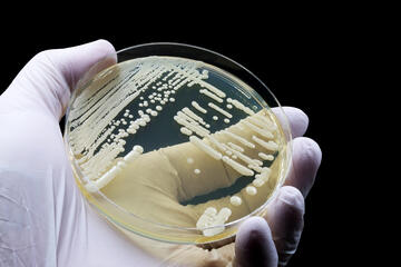 gloved hand holding petri dish containing streaks of white C. auris growth