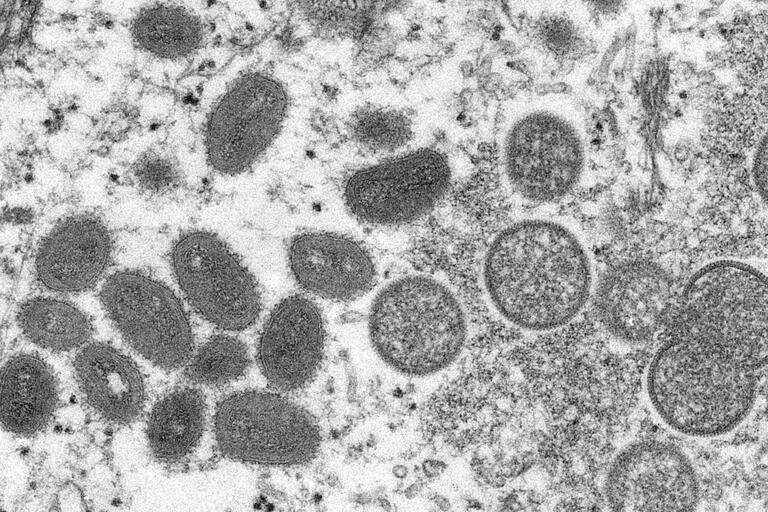 microscope image of monkeypox