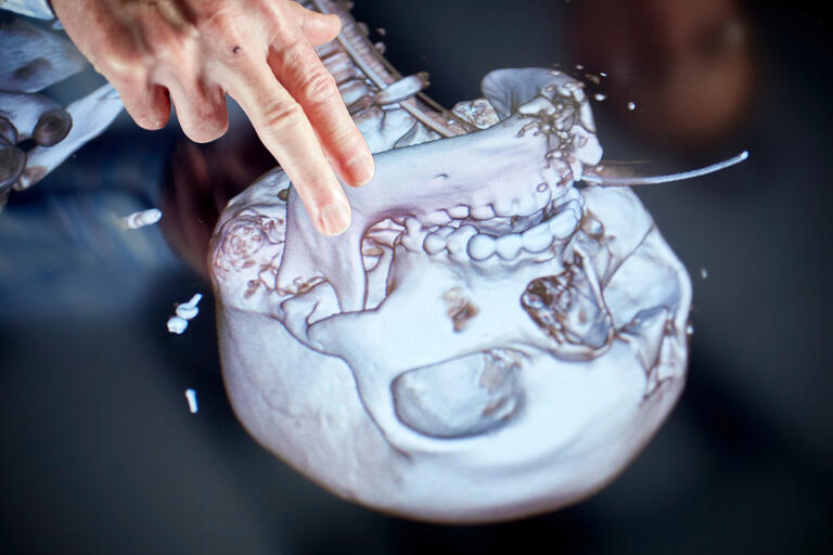 an image of a skeleton's skull reflected on the surface of an anatomy table