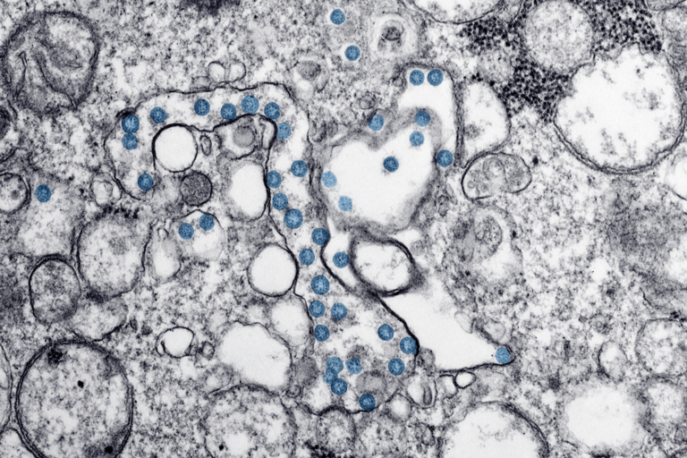 A microscopic image of the coronavirus disease.