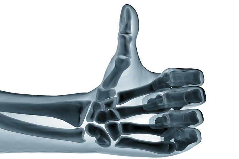 Photo of Thumb x-ray
